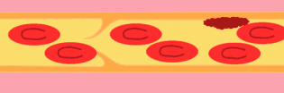 ʲôL(fng)